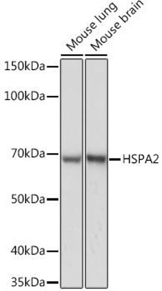 Anti-HSPA2 Antibody (CAB6652)