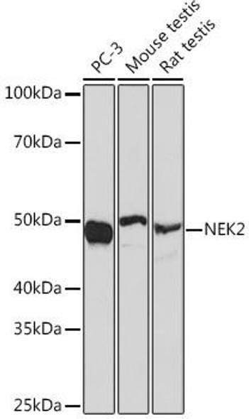 Anti-NEK2 Antibody (CAB6811)