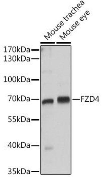 Anti-FZD4 Antibody (CAB8161)