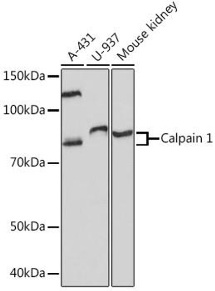 Anti-Calpain 1 Antibody (CAB8710)