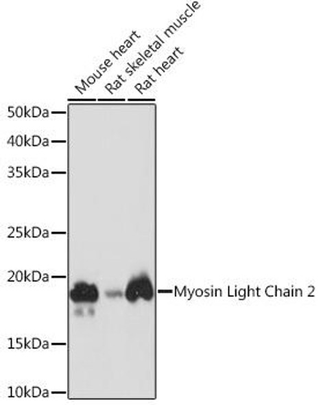 Anti-Myosin Light Chain 2 Antibody (CAB8742)