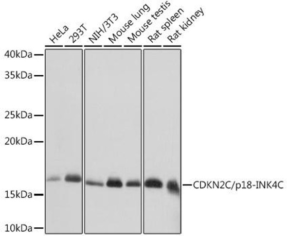 Anti-CDKN2C/p18-INK4C Antibody (CAB8751)