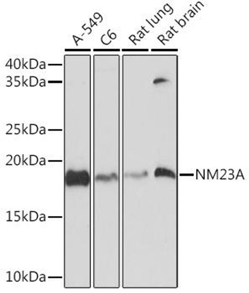 Anti-NM23A Antibody (CAB8802)