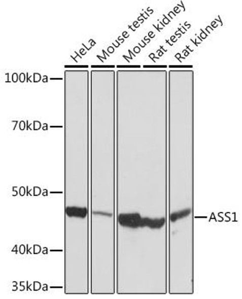 Anti-ASS1 Antibody (CAB9084)