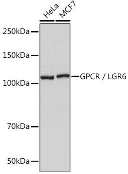 Anti-GPCR / LGR6 Antibody (CAB9128)