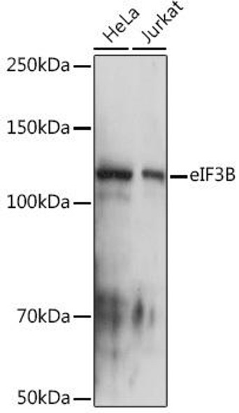 Anti-eIF3B Antibody (CAB9143)