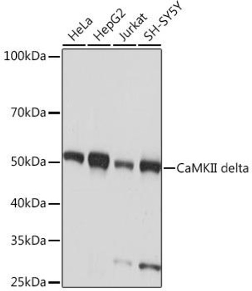Anti-CaMKII delta Antibody (CAB9196)