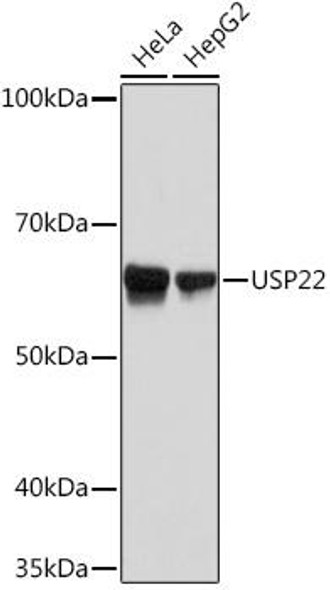 Anti-USP22 Antibody (CAB9261)