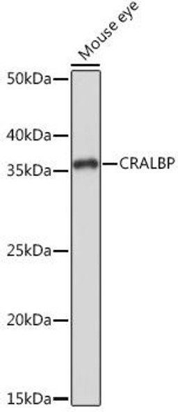 Anti-CRALBP Antibody (CAB9265)