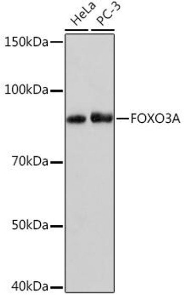 Anti-FOXO3A Antibody (CAB9270)
