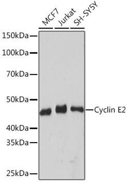 Anti-Cyclin E2 Antibody (CAB9305)