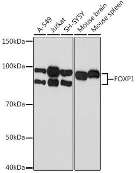 Anti-FOXP1 Antibody (CAB9540)