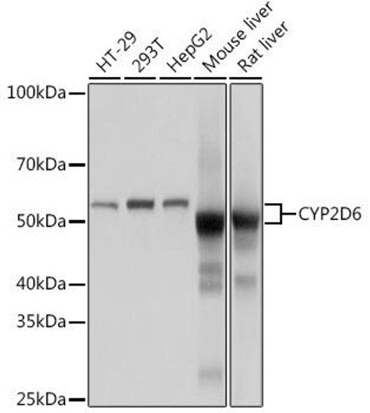 Anti-CYP2D6 Antibody (CAB9562)
