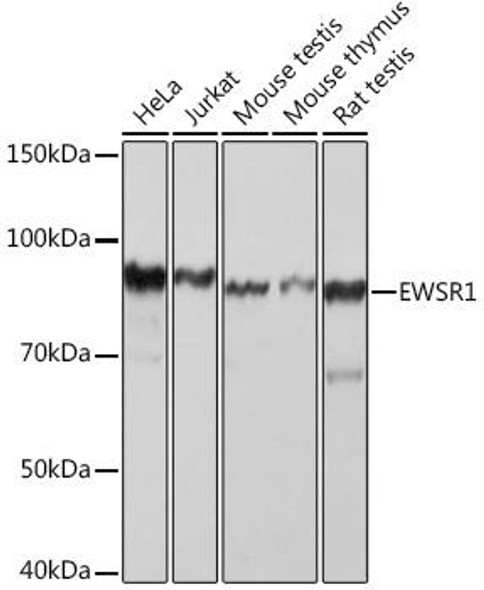 Anti-EWSR1 Antibody (CAB9640)