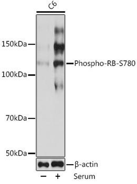 Anti-Phospho-RB-S780 Antibody (CABP0117)