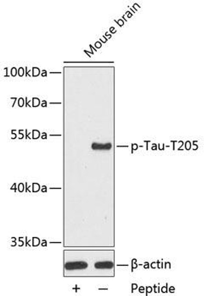 Anti-Phospho-Tau-T205 Antibody (CABP0168)