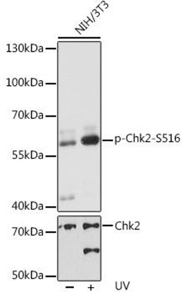 Anti-Phospho-Chk2-S516 Antibody (CABP0604)