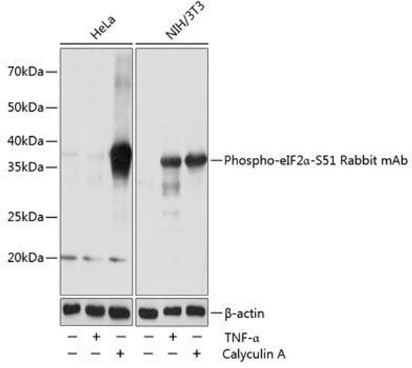 Anti-Phospho-eIF2Alpha-S51 Antibody (CABP0692)
