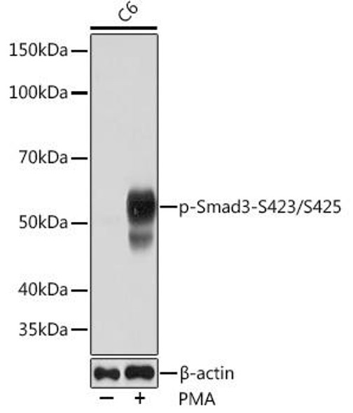 Anti-Phospho-Smad3-S423/S425 Antibody (CABP0727)