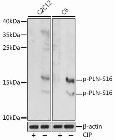 Anti-Phospho-PLN-S16 Antibody (CABP0907)