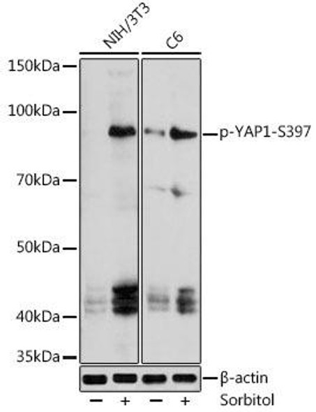 Anti-phospho-YAP1-S397 Antibody (CABP0922)