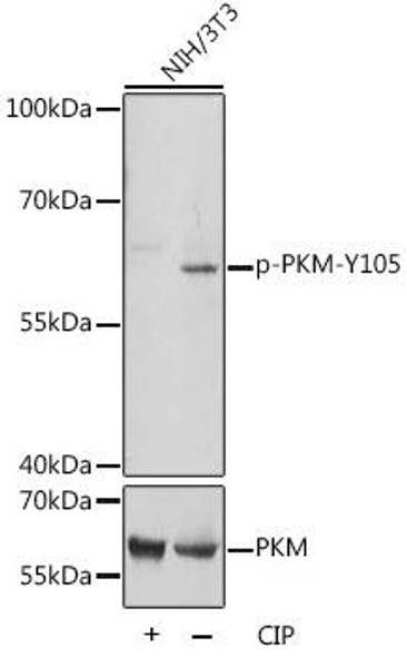 Anti-Phospho-PKM-Y105 Antibody (CABP0924)