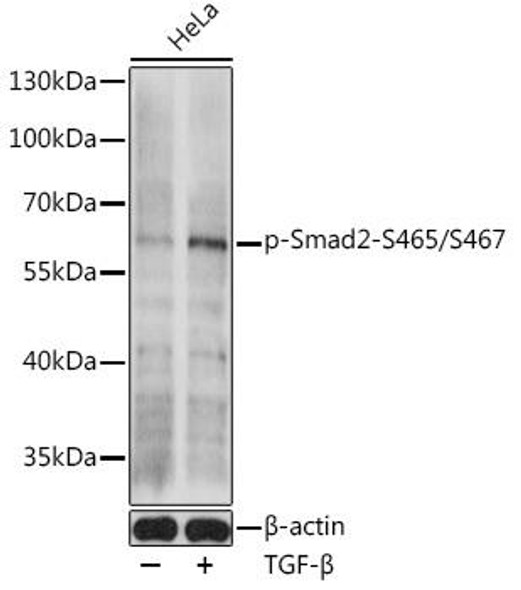 Anti-Phospho-Smad2-S465/S467 Antibody (CABP0925)