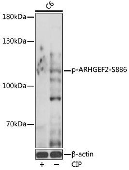 Anti-Phospho-ARHGEF2-S886 Antibody (CABP0926)
