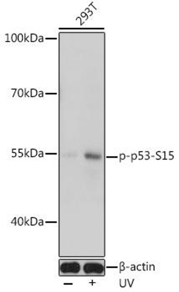 Anti-Phospho-p53-S15 Antibody (CABP0950)