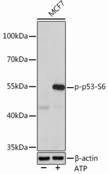 Anti-Phospho-p53-S6 Antibody (CABP0951)
