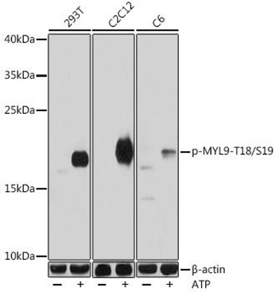Anti-Phospho-MYL9-T18/S19 Antibody (CABP0955)