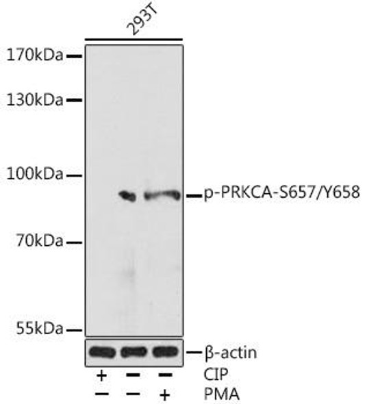 Anti-Phospho-PRKCA-S657/Y658 Antibody (CABP0970)
