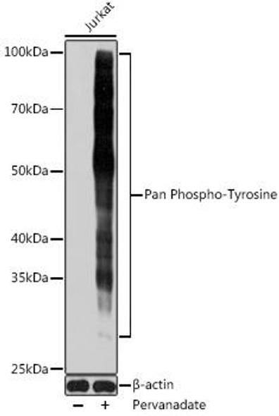 Anti-Pan Phospho-Tyrosine Antibody (CABP0973)