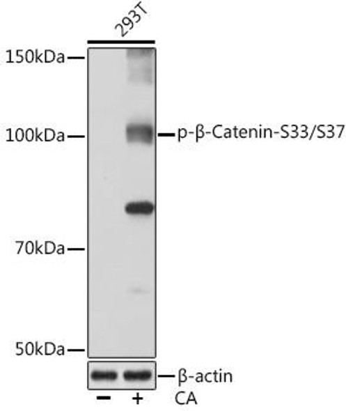 Anti-Phospho-Beta-Catenin-S33/S37 Antibody (CABP0979)