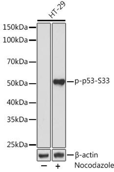 Anti-Phospho-p53-S33 Antibody (CABP0984)