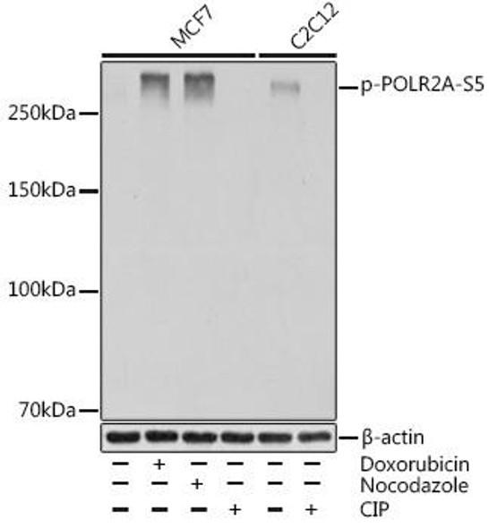 Anti-Phospho-POLR2A-S5 Antibody (CABP0997)