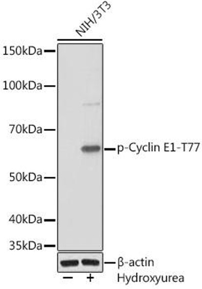 Anti-Phospho-Cyclin E1-T77 Antibody (CABP1014)