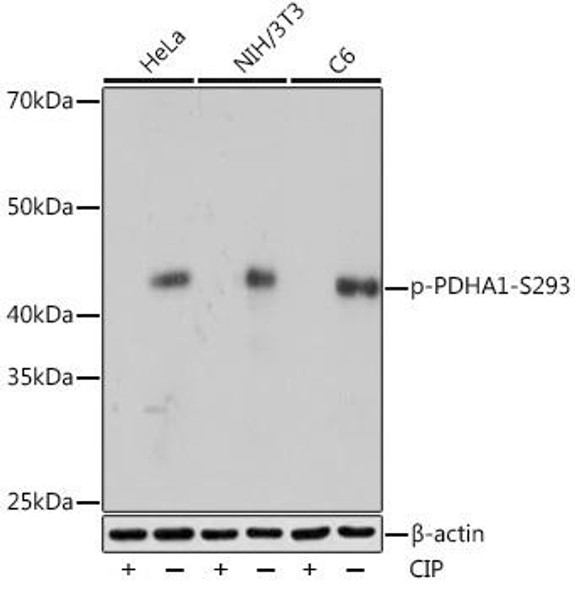 Anti-Phospho-PDHA1-S293 Antibody (CABP1022)