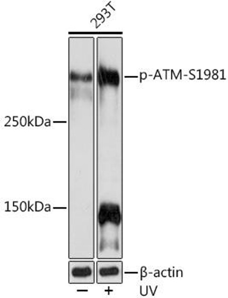 Anti-Phospho-ATM-S1981 Antibody (CABP1030)