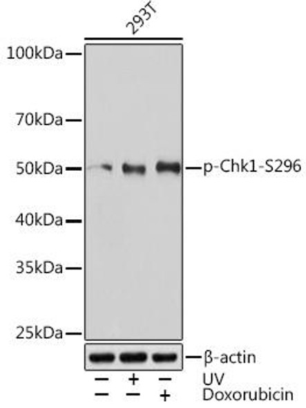 Anti-Phospho-Chk1-S296 Antibody (CABP1047)