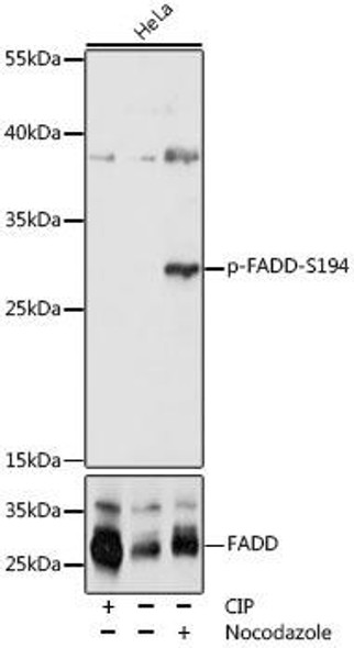 Anti-Phospho-FADD-S194 Antibody (CABP1054)