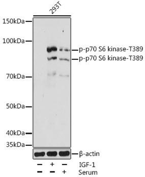 Anti-Phospho-p70 S6 kinase-T389 Antibody (CABP1059)
