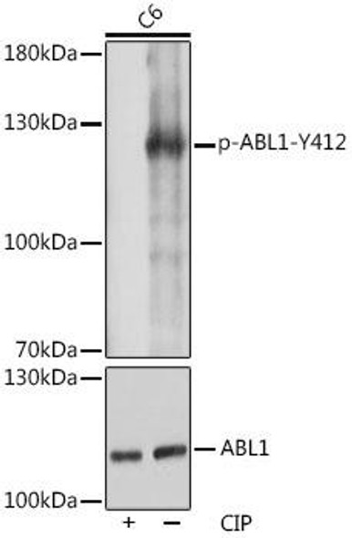 Anti-Phospho-ABL1-Y412 Antibody (CABP1060)