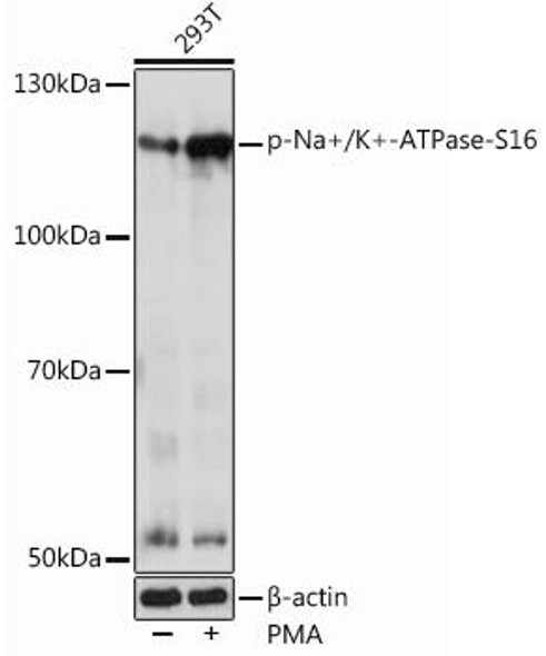 Anti-Phospho-Na+/K+-ATPase-S16 Antibody (CABP1065)