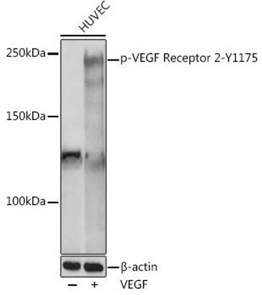 Anti-Phospho-VEGF Receptor 2-Y1175 Antibody (CABP1095)