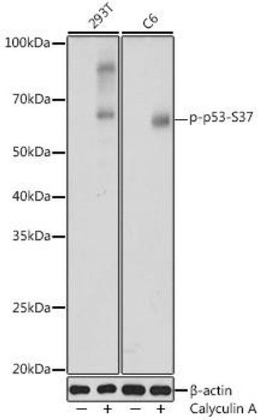 Anti-Phospho-p53-S37 Antibody (CABP1110)