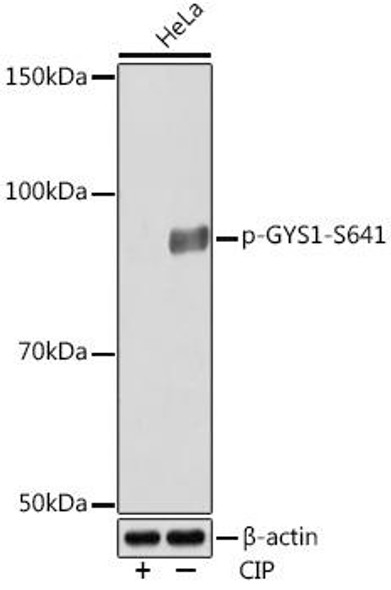 Anti-Phospho-GYS1-S641 Antibody (CABP1129)
