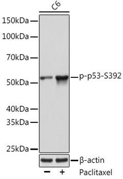 Anti-Phospho-p53-S392 Antibody (CABP1137)