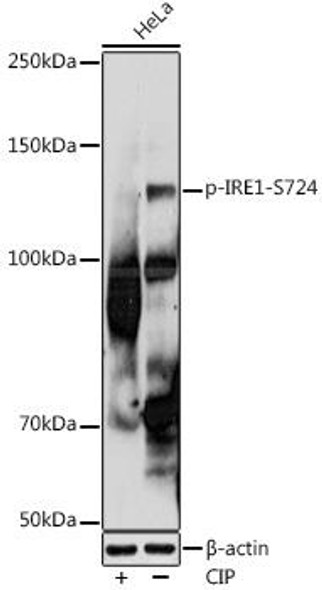 Anti-Phospho-IRE1-S724 Antibody (CABP1146)
