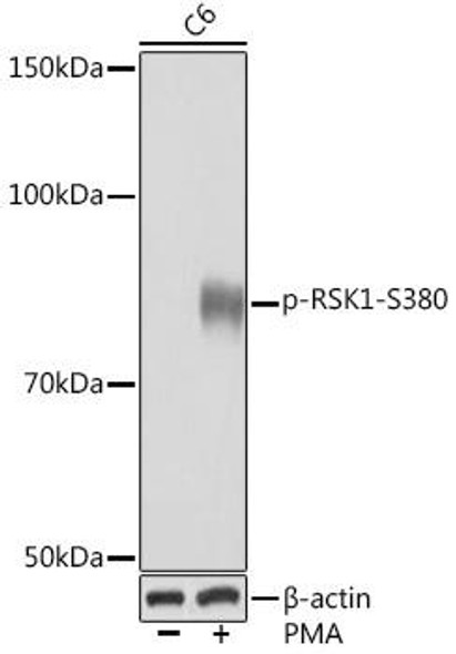 Anti-Phospho-RSK1-S380 Antibody (CABP1147)